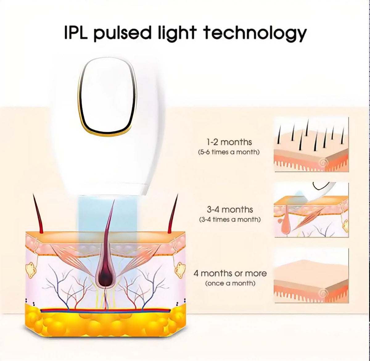 Mini IPL laser hair removal device for at-home use, photo 4